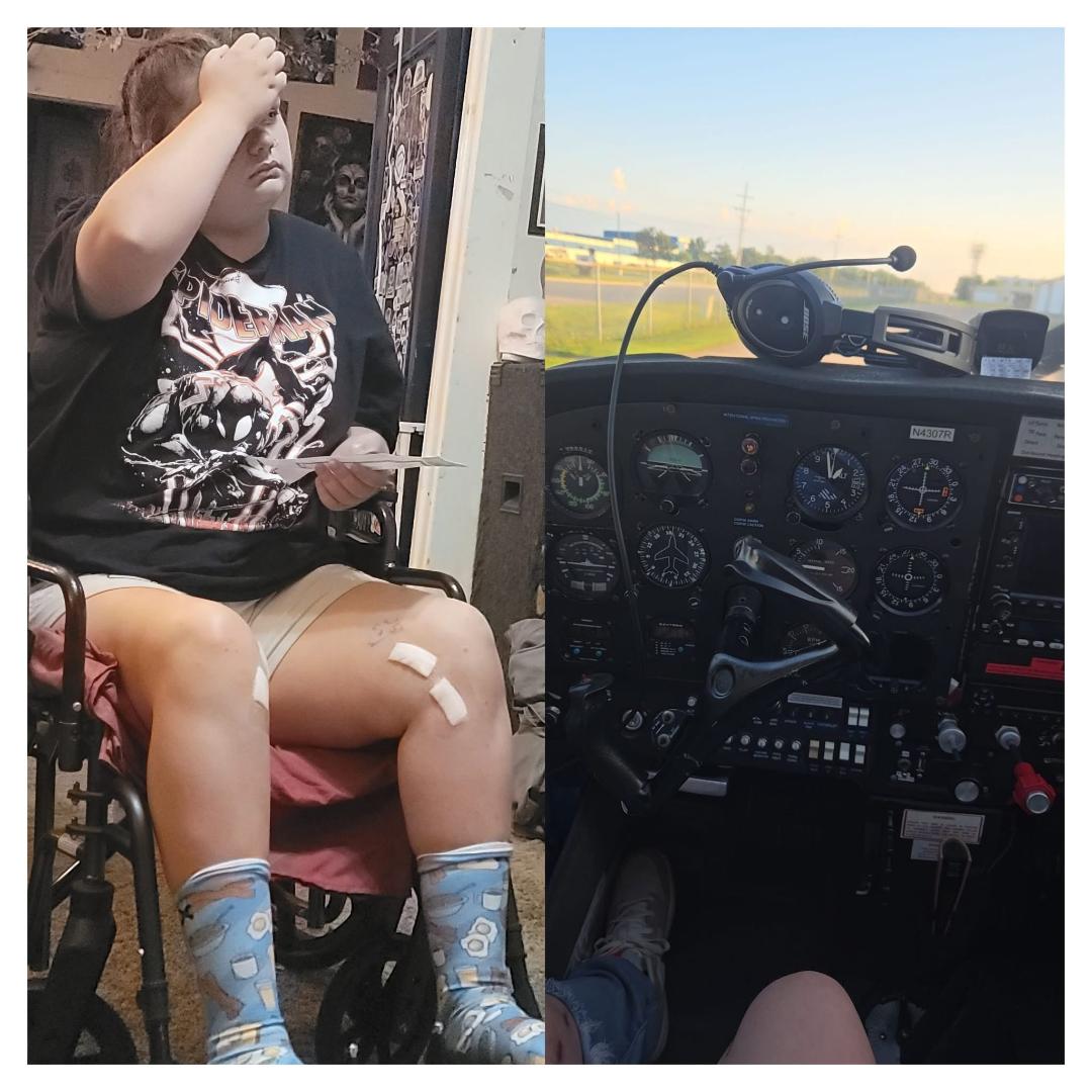 Left after Libby's last surgery Right_One year ago flying